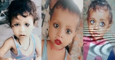Three children died of chicken pox in Kaithi village of Rath