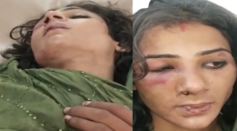 Mahoba Crime News: Mistaking a girl for a eunuch, she was molested and robbed