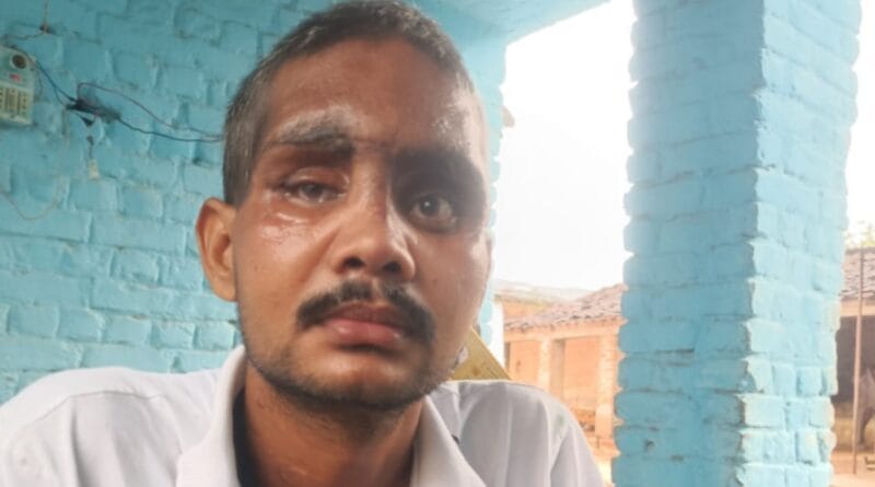 Chilli Murder Big Statement: One Not Four Masked